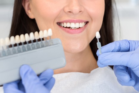 Teeth Whitening