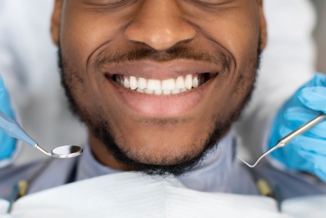 Tooth Bonding & Fillings