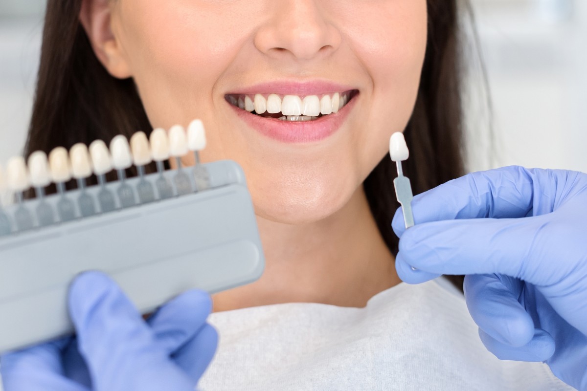 Teeth Whitening