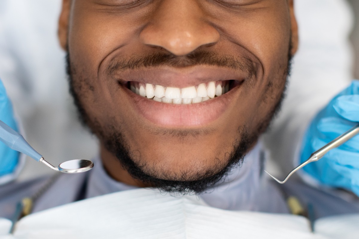 Tooth Bonding & Fillings 